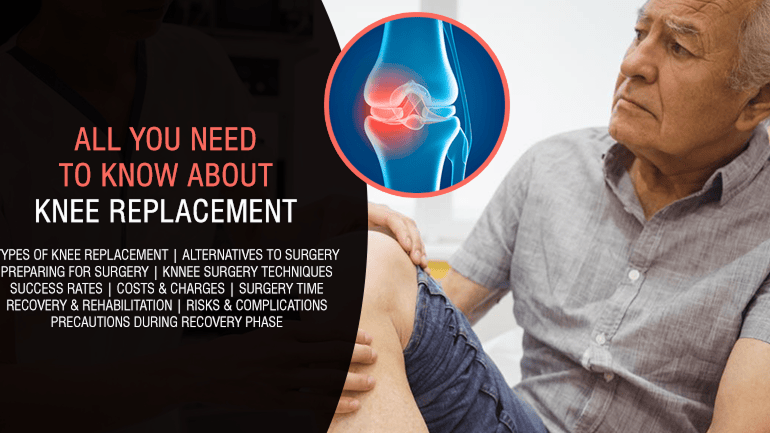 All You Need to Know About Knee Joint Replacement Surgery