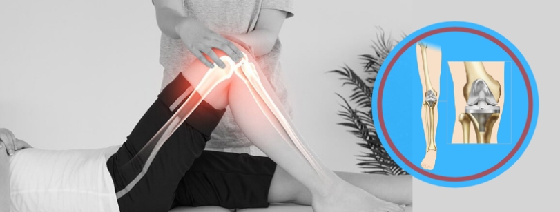 How can knee replacement surgery improve your living?