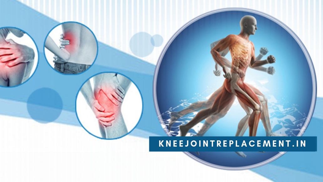 When to Have a Knee Joint Replacement Surgery