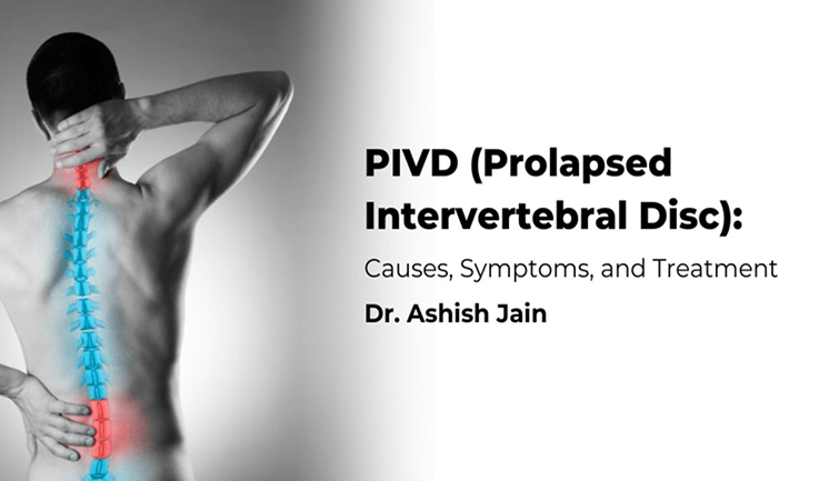PIVD (Prolapsed Intervertebral Disc): Causes, Symptoms, and Treatment