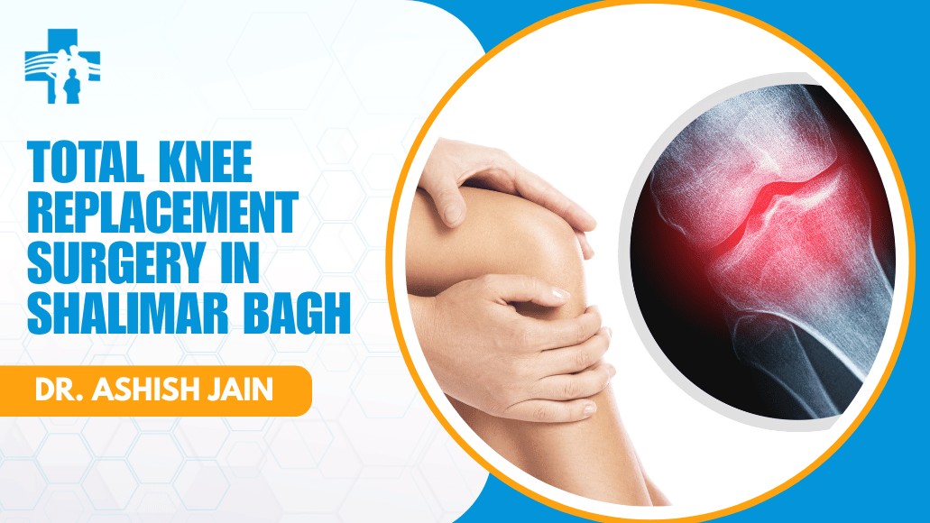 Total Knee Replacement Surgery in Shalimar Bagh
