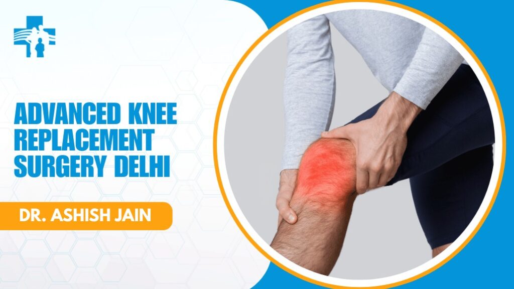 Advanced Knee Replacement Surgery Delhi