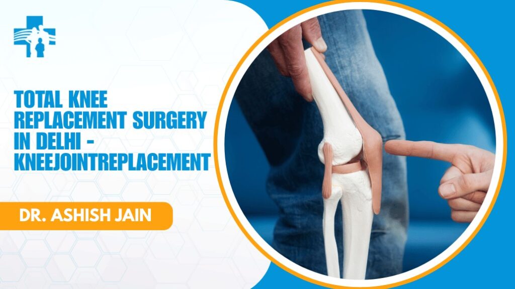 Total Knee Replacement Surgery in Delhi