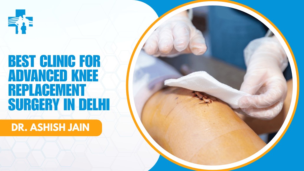 Advanced Knee Replacement Surgery Delhi
