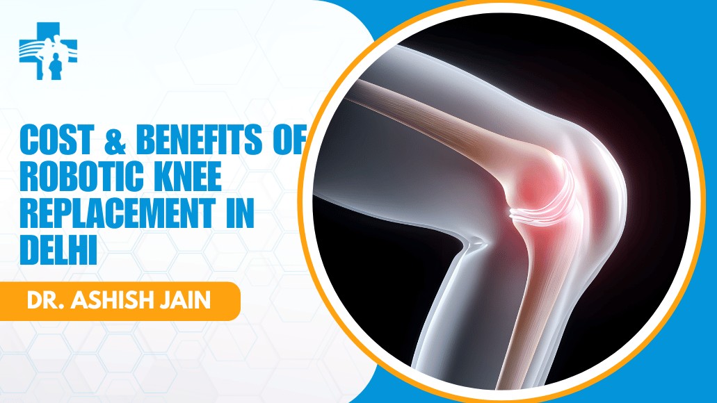 Cost & Benefits of Robotic Knee Replacement in Delhi