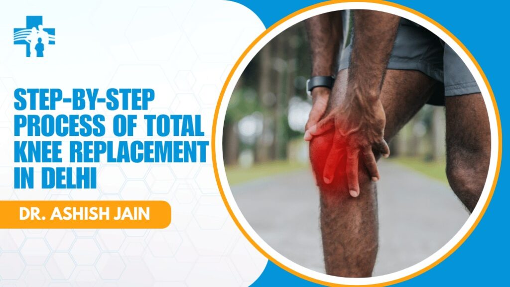 Total Knee Replacement Surgery in Delhi