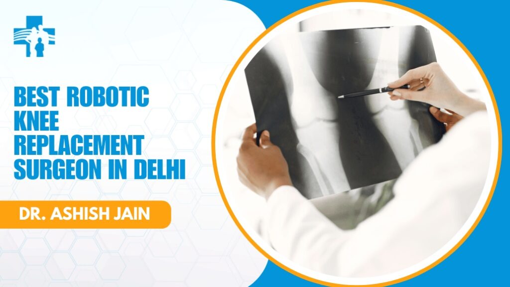 Robotic Knee Replacement Surgeon in Delhi