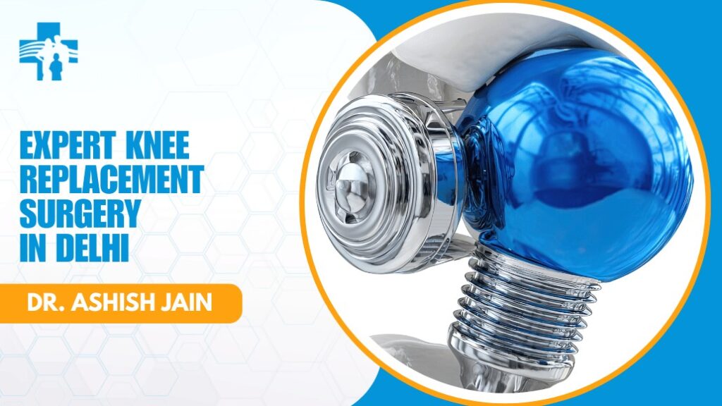 Best Knee Replacement Surgeon in Delhi
