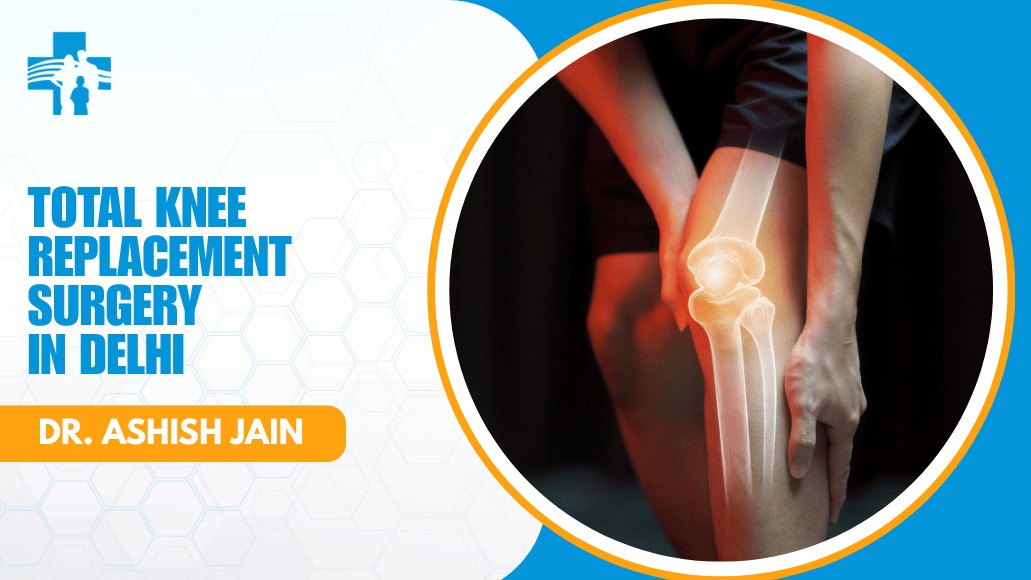 Total Knee Replacement Surgery