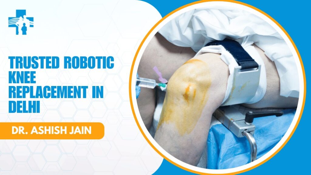 Robotic Knee Replacement Expert in Delhi