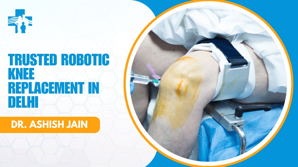 Robotic Knee Replacement Expert in Delhi
