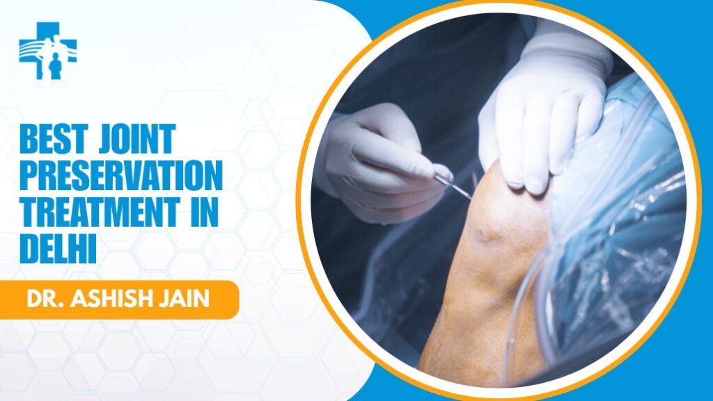 Joint Preservation Treatment in Delhi