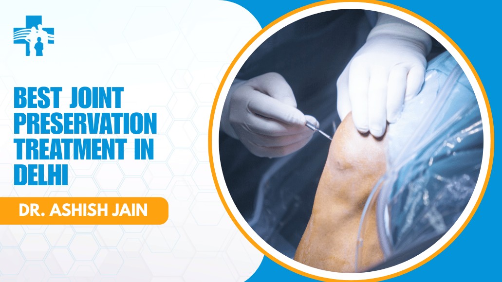 Best Joint Preservation Treatment in Delhi