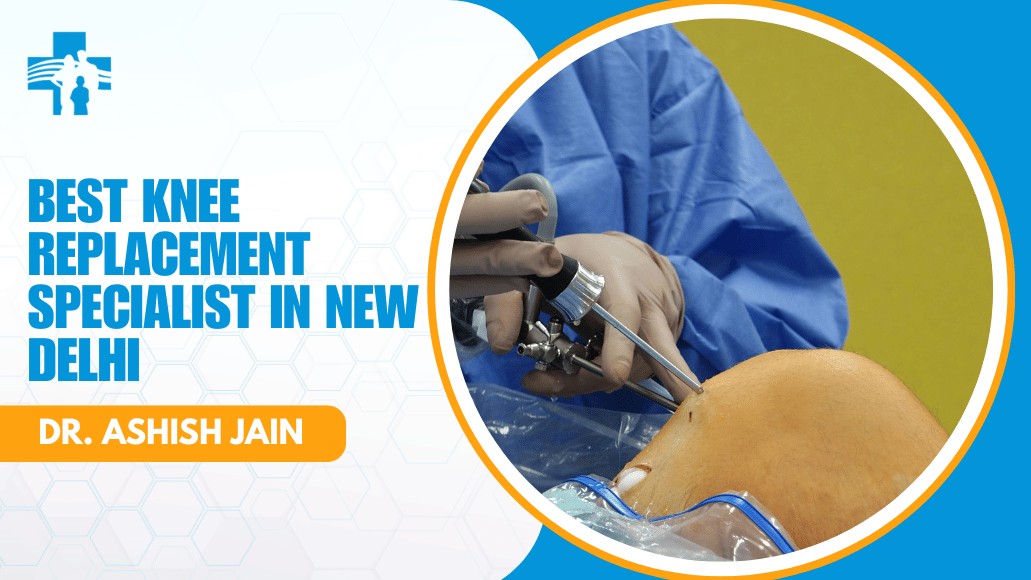 Knee Replacement Specialist in New Delhi