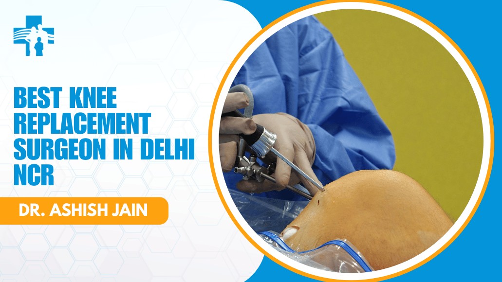 Best Knee Replacement Surgeon in Delhi