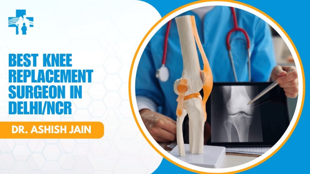 Knee Replacement Surgeon in Delhi/NCR