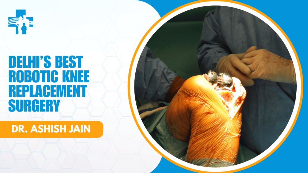Delhi’s Best Robotic Knee Replacement Surgery by Dr. Ashish Jain