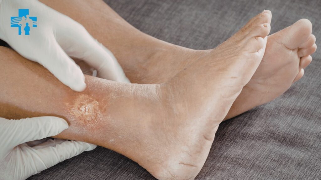 Best Joint Preservation Treatment in Delhi