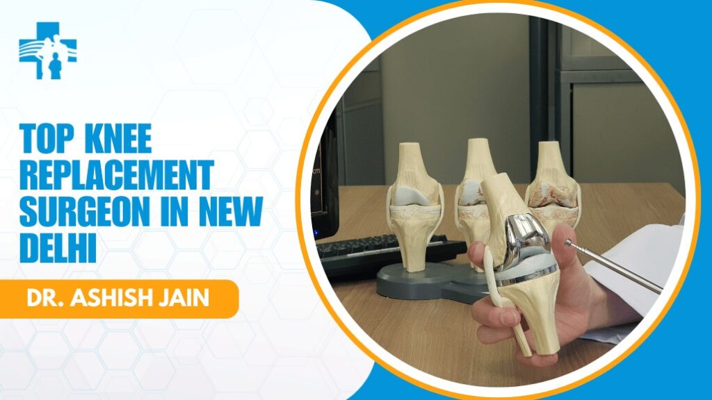 Knee Replacement Surgeon in New Delhi