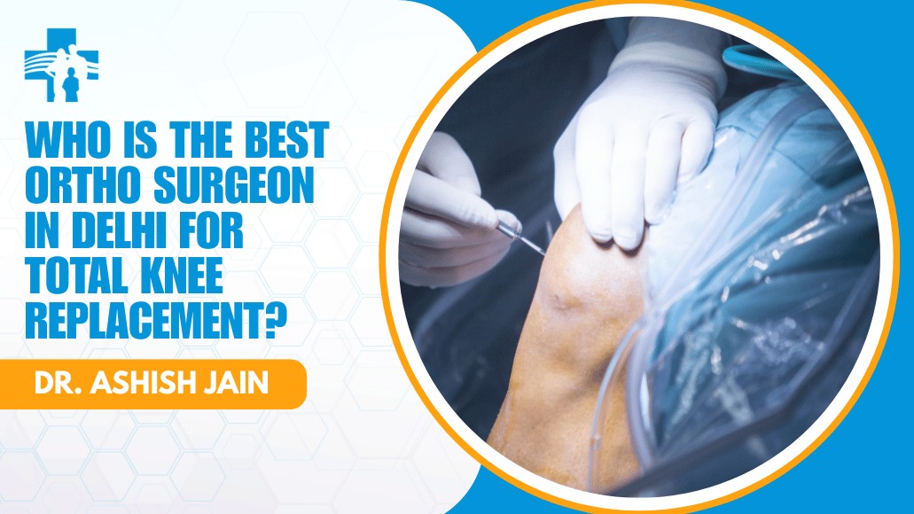 Total Knee Replacement Surgery in Delhi
