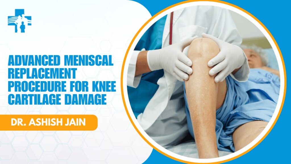 Meniscal Replacement Procedure