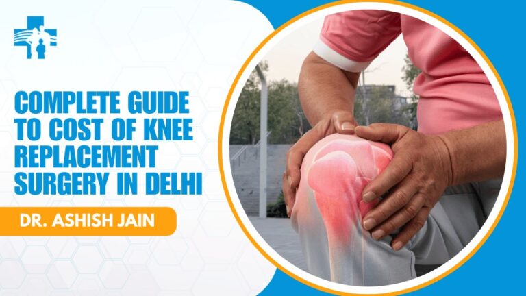 Complete Guide to Cost of Knee Replacement Surgery in Delhi