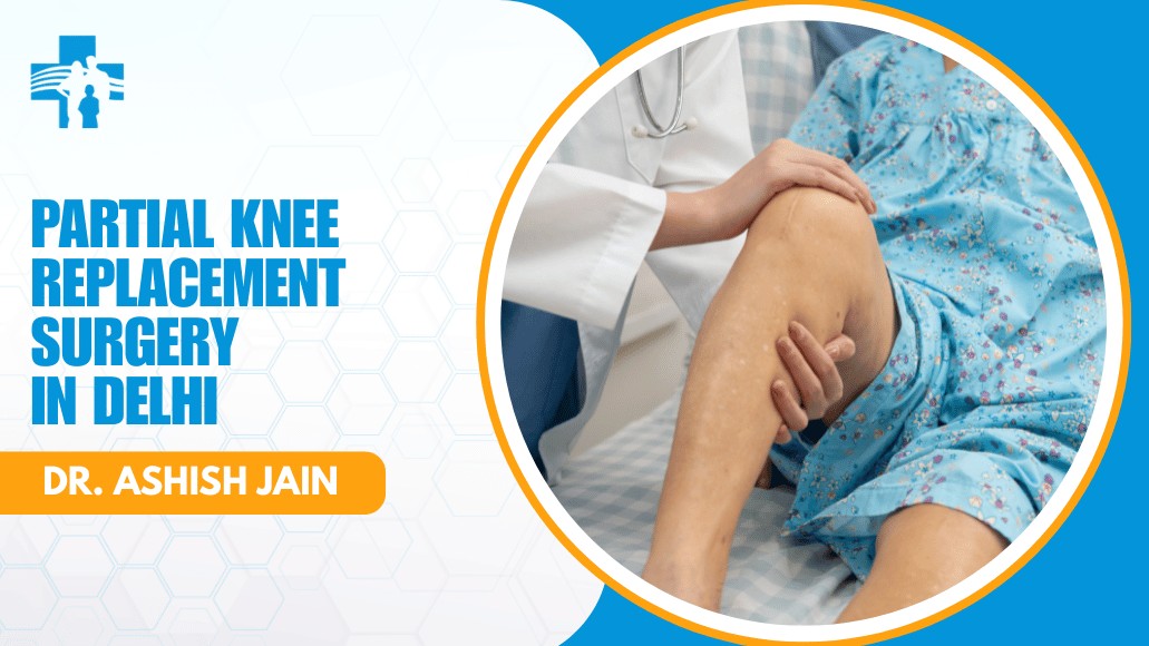 Partial knee replacement
