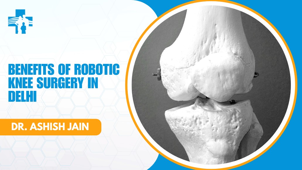 Robotic Knee Replacement in Delhi