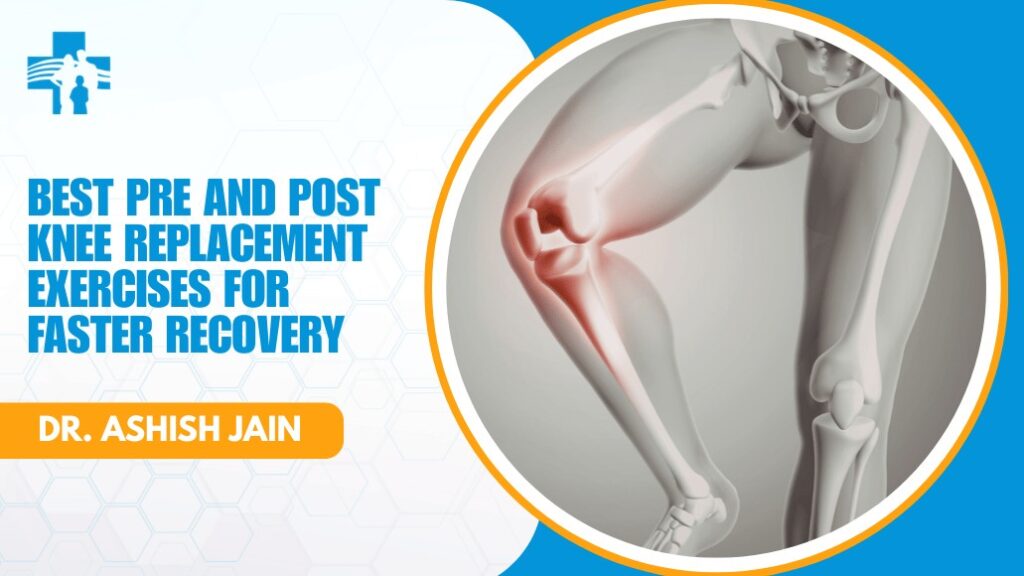 Knee Pain Specialist Doctor in Delhi