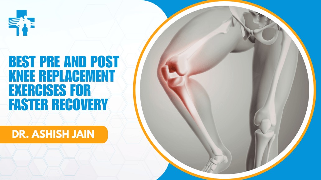 Knee Pain Specialist Doctor in Delhi