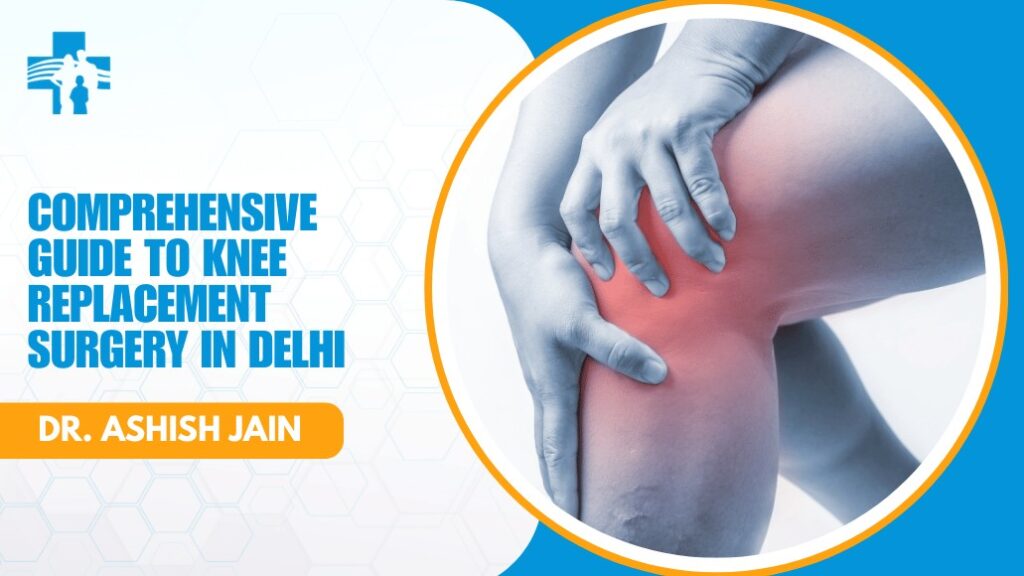 Total Knee Replacement Surgery in Delhi