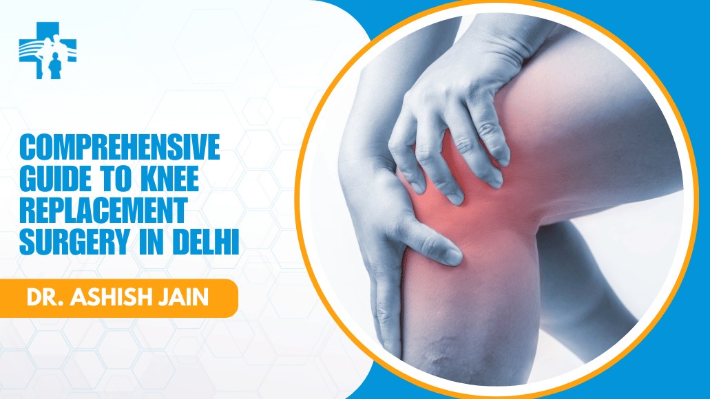 Comprehensive Guide to Knee Replacement Surgery in Delhi