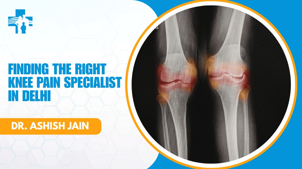 Knee Pain Specialist Doctor in Delhi