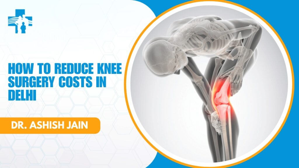 Cost of Knee Replacement Surgery in Delhi