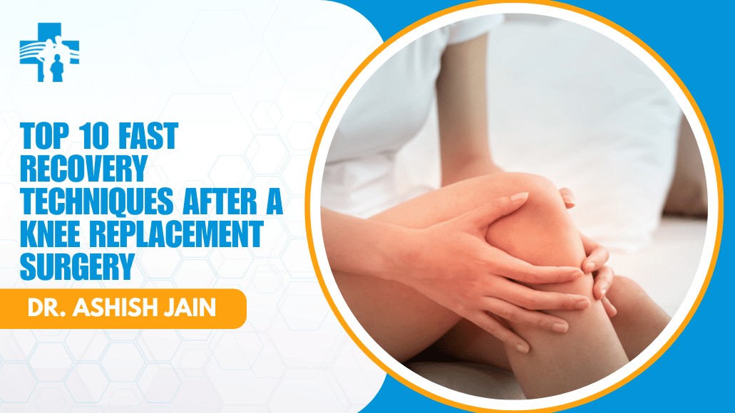 Top 10 Fast Recovery Techniques After A Knee Replacement Surgery