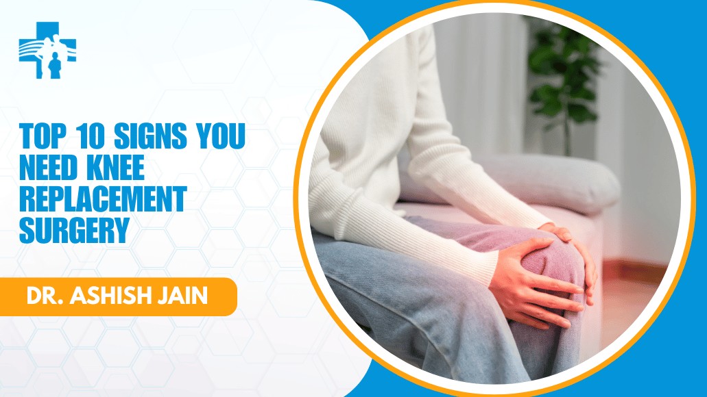 Signs of knee replacement