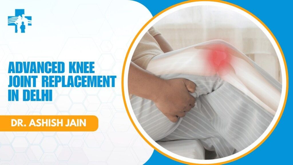 Knee Joint Replacement Specialist in Delhi