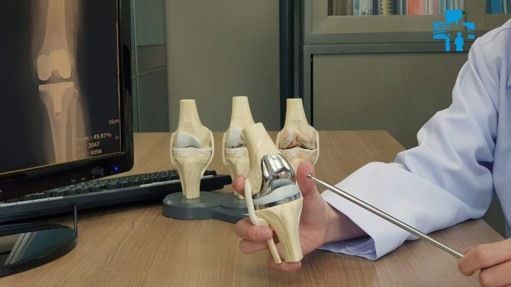 Minimally invasive knee replacement technique with a smaller incision at Max Shalimar Bagh, Delhi