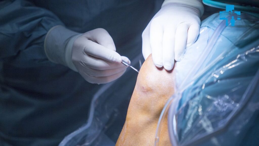 Navigation screen showing implant alignment during computer-assisted knee surgery in Delhi
