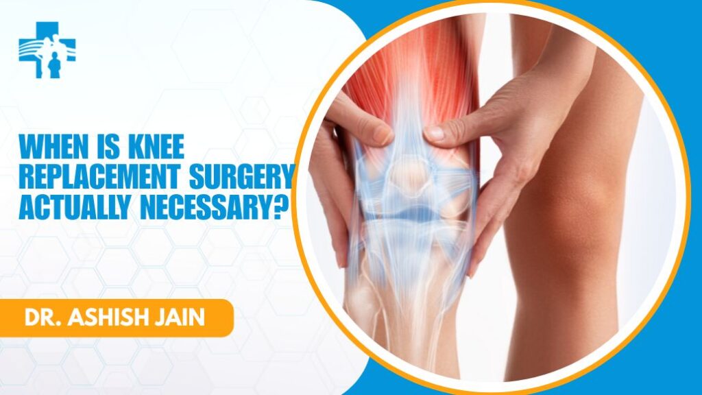 Knee replacement necessity consultation with Dr Ashish Jain in Delhi