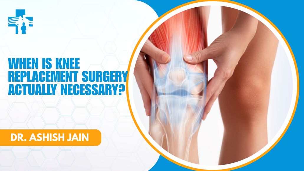 Knee replacement necessity consultation with Dr Ashish Jain in Delhi