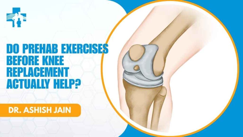 Prehab exercise consultation with Dr. Ashish Jain in Rohini