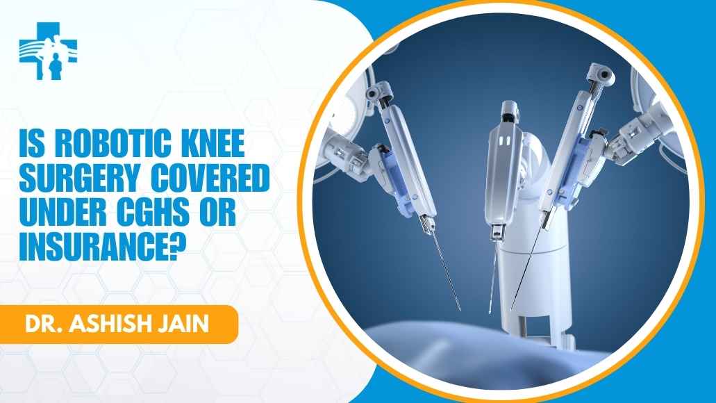 Is Robotic Knee Surgery Covered Under CGHS or Insurance?