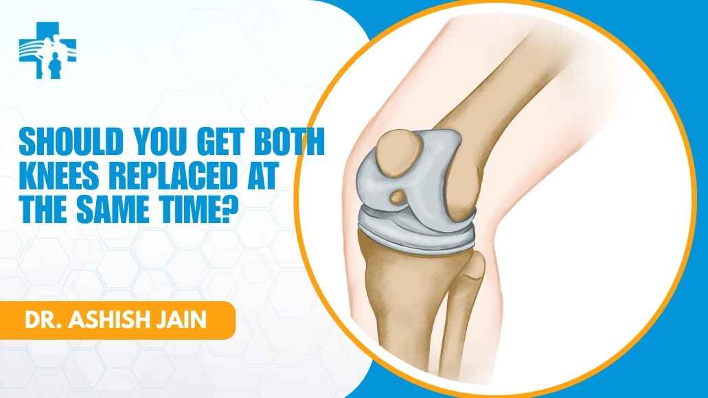 Bilateral knee replacement decision consultation with Dr. Ashish Jain in Delhi