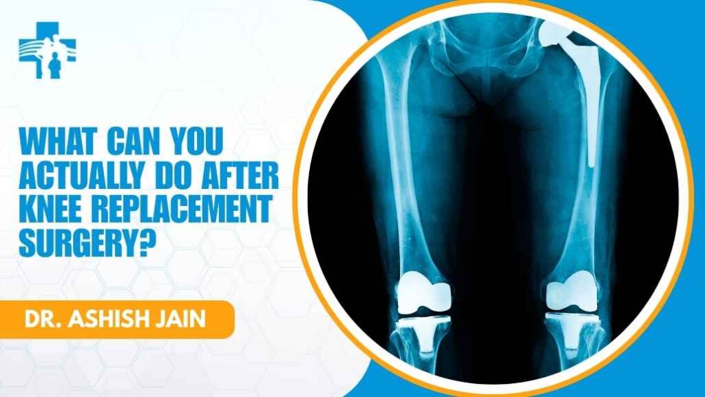 Consultation on daily activities after knee replacement with Dr. Ashish Jain
