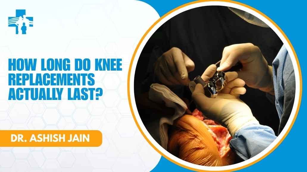 Knee implant longevity consultation with Dr. Ashish Jain in Delhi