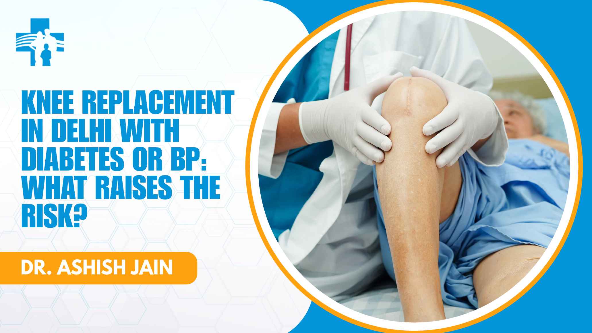Knee Replacement in Delhi With Diabetes or BP: What Raises the Risk?