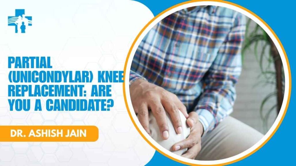 Partial unicondylar knee replacement candidacy
