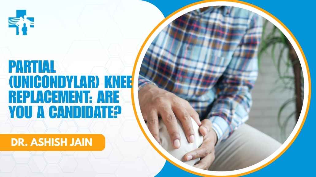 Partial unicondylar knee replacement candidacy
