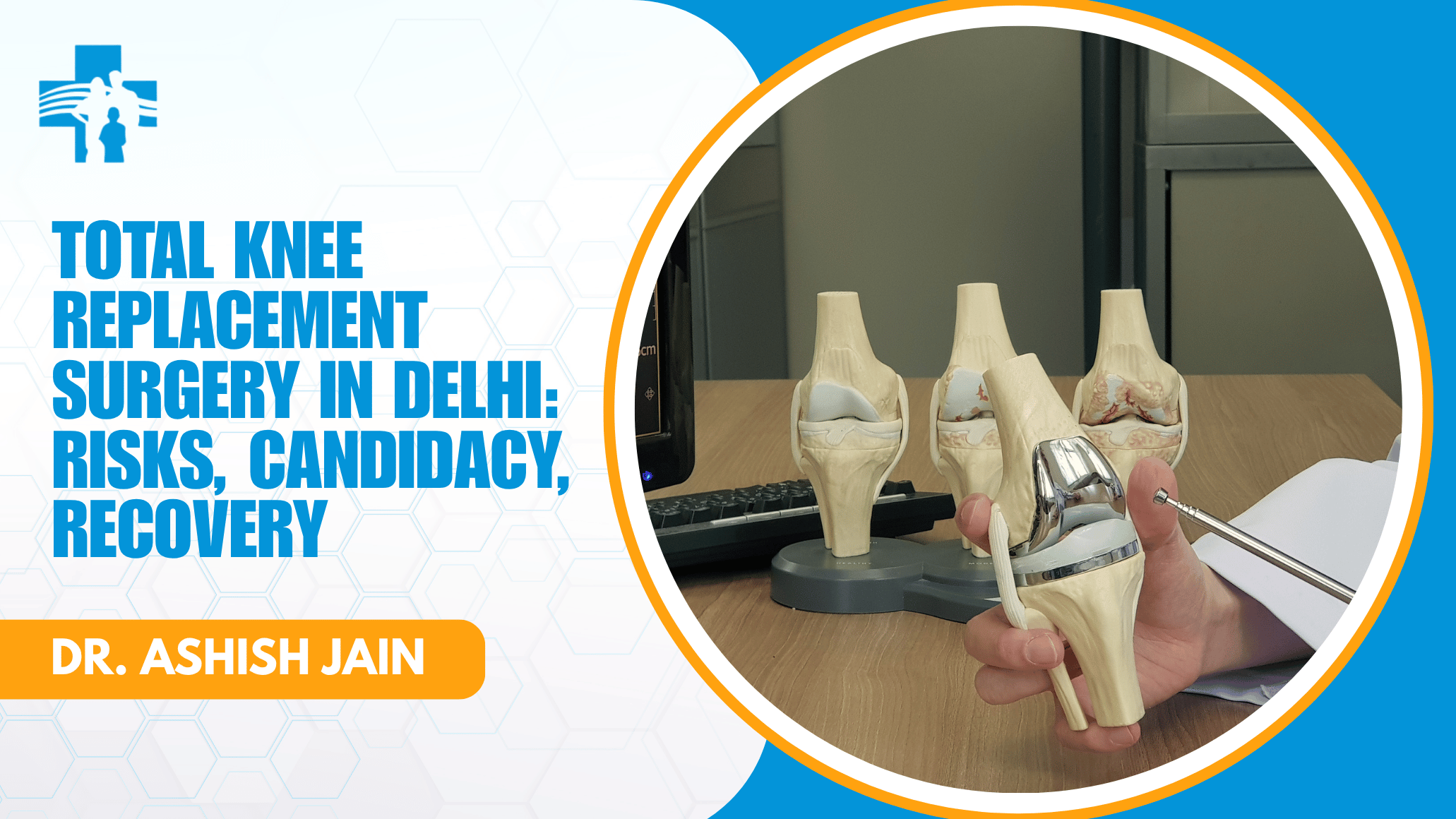 Total Knee Replacement Surgery in Delhi: Risks, Candidacy, Recovery